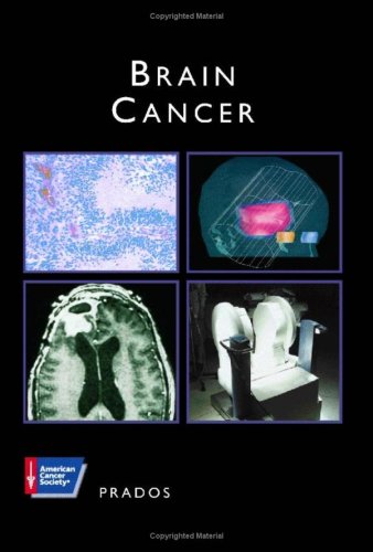 INCLUDES CD-ROM: Brain Cancer. American Cancer Society Atlas of Clinical Oncology.