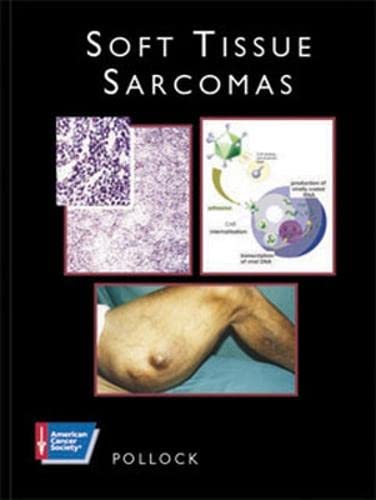 9781550091281: Soft Tissue Sarcomas: Atlas of Clinical Oncology (American Cancer Society Atlas of Clinical Oncology)