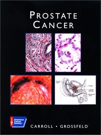 Beispielbild fr Prostate Cancer (American Cancer Society Atlas of Clinical Oncology) zum Verkauf von HPB-Ruby