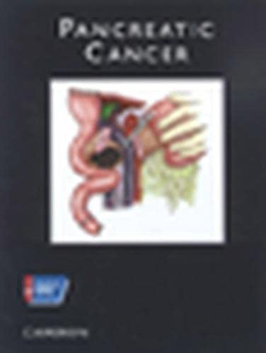 Atlas of Clinical Oncology: Pancreatic Cancer (ACS ATLAS OF CLINICAL ONCOLOGY) (9781550091311) by Cameron, John L.