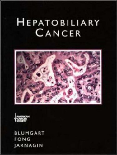 9781550091328: HEPATOBILIARY CANCER (AGENCY/DISTRIBUTED)