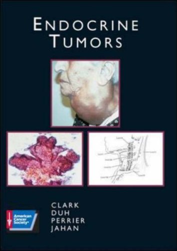 Imagen de archivo de Endocrine Tumors: American Cancer Society Atlas of Clinical Oncology a la venta por HPB-Movies