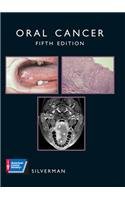 Imagen de archivo de Oral Cancer a la venta por Better World Books