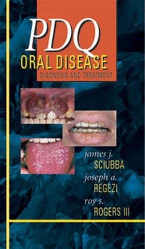 Stock image for PDQ Oral Disease Diagnosis and Treatment for sale by HPB-Red