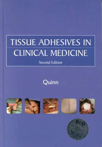 Beispielbild fr Tissue Adhesives in Clinical Medicine (BC DECKER) zum Verkauf von AwesomeBooks