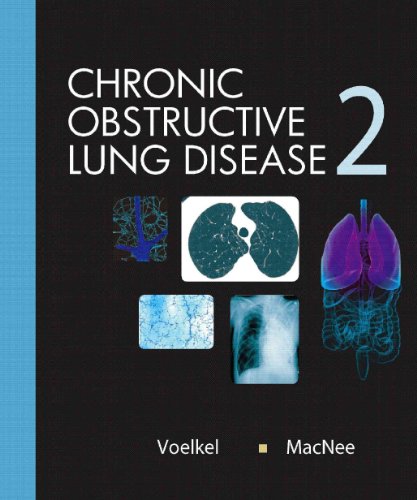 Stock image for Chronic Obstructive Lung Disease for sale by Better World Books Ltd