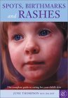 Imagen de archivo de Spots, Birthmarks and Rashes : The Complete Guide to Caring for Your Child's Skin a la venta por Better World Books