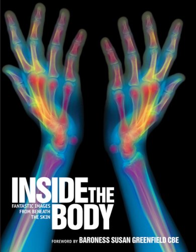 9781554073177: Inside the Body: Fantastic Images from Beneath the Skin