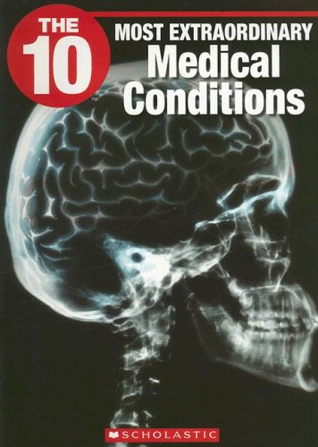 Beispielbild fr The 10 Most Extraordinary Medical Conditions zum Verkauf von Better World Books: West