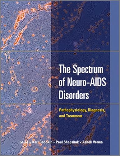 Beispielbild fr The Spectrum of Neuro-Aids Disorders zum Verkauf von Majestic Books