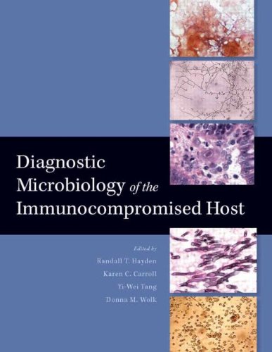 Stock image for DIAGNOSTIC MICROBIOLOGY OF THE IMMUNOCOMPROMISED HOST for sale by Basi6 International
