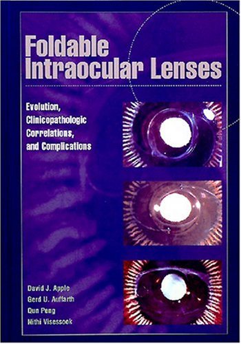 Stock image for Foldable Intraocular Lenses : Evolution, Clinicopathologic Correlations and Complications for sale by Better World Books