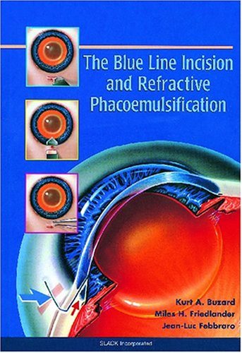 Imagen de archivo de The Blue Line Incision and Refractive Phacoemulsification a la venta por Better World Books