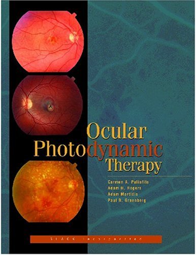 Stock image for Ocular Photodynamic Therapy for sale by Better World Books