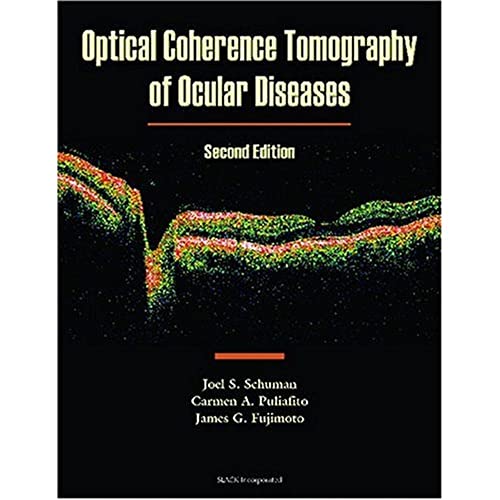 Stock image for Optical Coherence Tomography of Ocular Diseases for sale by ThriftBooks-Atlanta