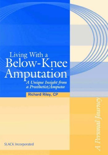 9781556426926: Living With A Below-Knee Amputation: A Unique Insight From A Prosthetist/Amputee