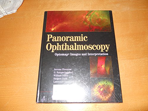 Stock image for Panoramic Ophthalmoscopy: Optomap Images and Interpretation for sale by Goodwill of Colorado