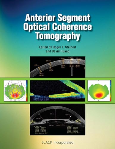 Stock image for Anterior Segment Optical Coherence Tomography for sale by Save With Sam