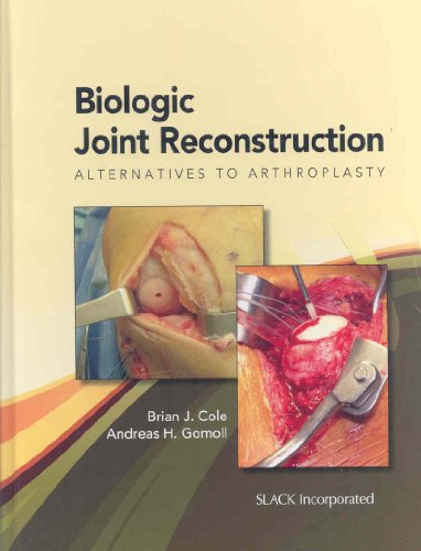 9781556428500: Biologic Joint Reconstruction: Alternatives to Joint Arthroplasty