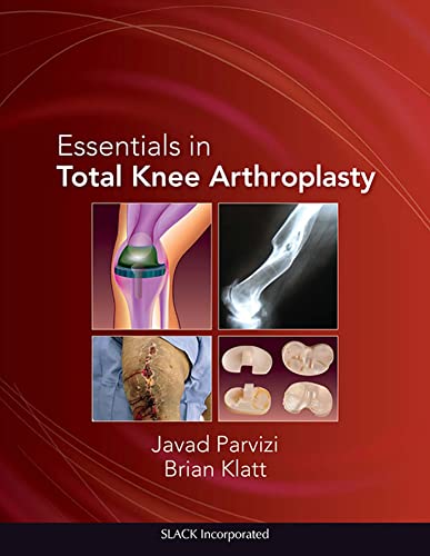 Imagen de archivo de Essentials in Total Knee Arthroplasty a la venta por ZBK Books