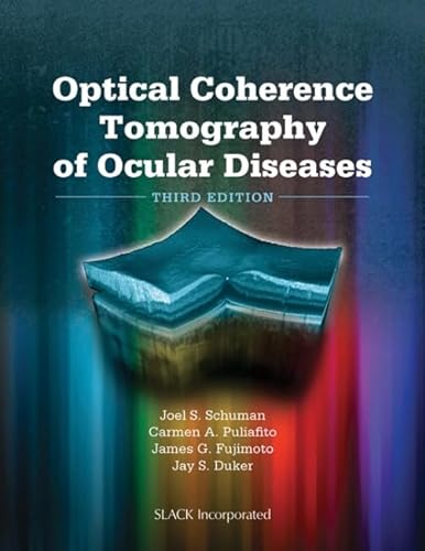 Stock image for Optical Coherence Tomography of Ocular Diseases for sale by BooksRun