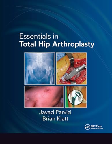 Stock image for Essentials in Total Hip Arthroplasty for sale by California Books