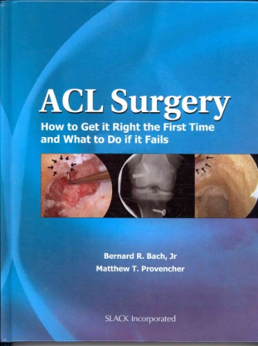 Stock image for ACL Surgery: How To Get It Right the First Time and What To Do if it Fails for sale by HPB-Red