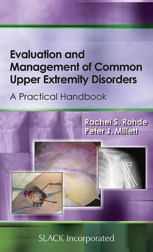 Imagen de archivo de Evaluation and Management of Common Upper Extremity Disorders: A Practical Handbook a la venta por Anybook.com