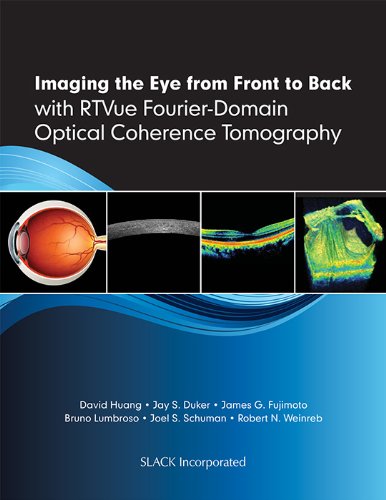 9781556429637: Imaging the Eye from Front to Back With RTVue Fourier-Domain Optical Coherence Tomogaphy