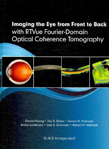 9781556429637: Imaging the Eye from Front to Back with RTVue Fourier-Domain Optical Coherence Tomogaphy