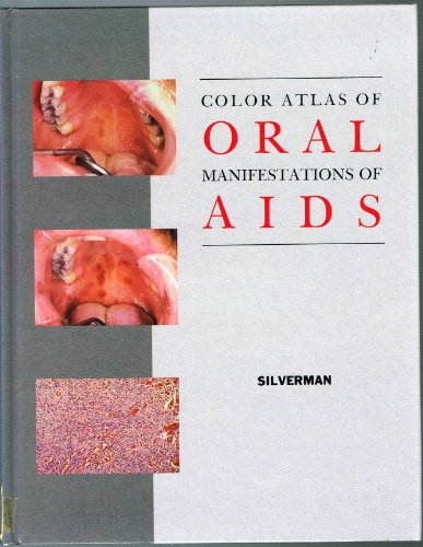 Beispielbild fr Color Atlas of Oral Manifestations of AIDS zum Verkauf von Valley down In