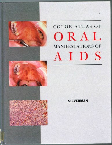 Stock image for Color Atlas of Oral Manifestations of AIDS for sale by Valley down In