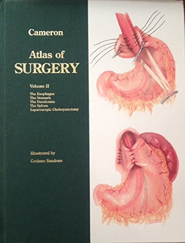 Atlas of Surgery: The Esophagus, the Stomach, the Duodenum, the Spleen, Laparoscopic Cholecystectomy (9781556642524) by Cameron, John L.