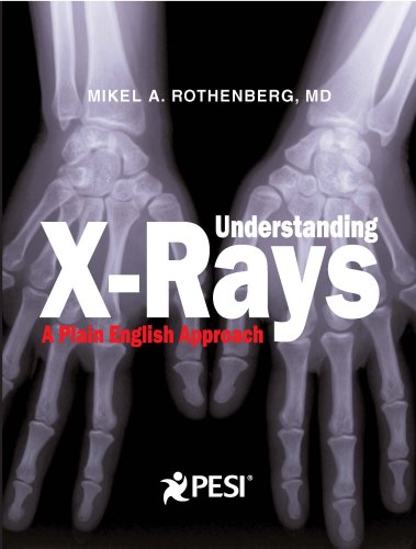 Beispielbild fr Understanding X-Rays: A Plain English Approach zum Verkauf von Better World Books