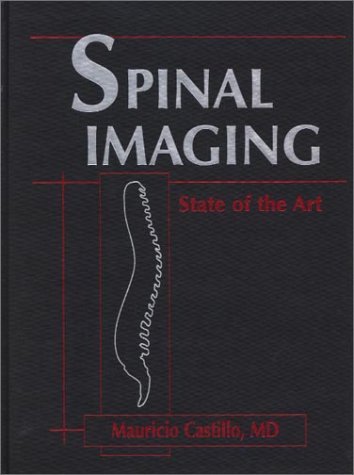 9781560534662: Spinal Imaging: State of the Art