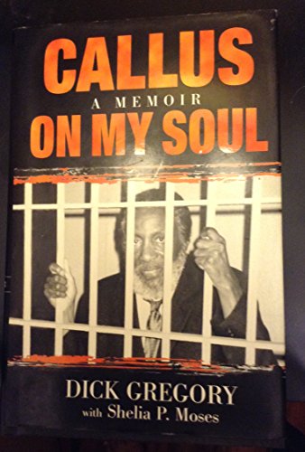 Stock image for Callus on My Soul: A Memoir for sale by Outer Print