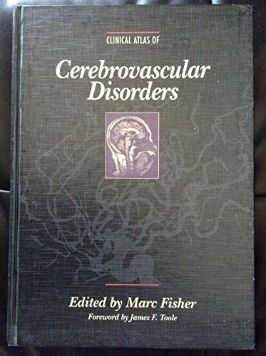 Cinical Atlas of Cerebrovascular Disorders. Foreword by James F. Toole.