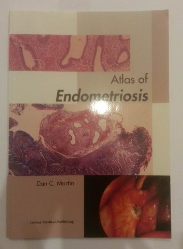 9781563755477: Atlas of Endometriosis