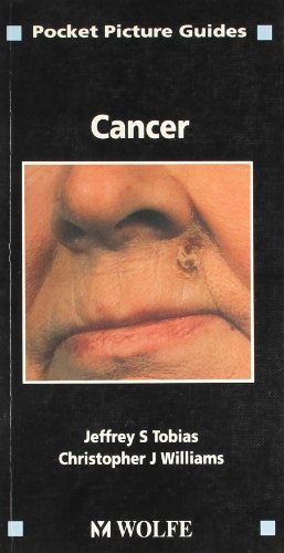 Beispielbild fr Pocket Picture Guide to Cancer (Pocket Picture Guides to Clinical Medicine S.) zum Verkauf von Reuseabook