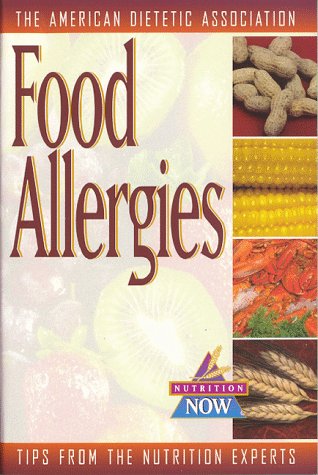 Stock image for Food Allergies : Up-to-Date Tips from the World's Foremost Nutrition Experts for sale by Better World Books: West