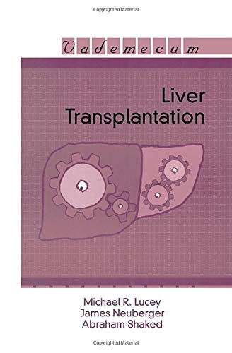 Imagen de archivo de Liver Transplantation a la venta por Plum Books