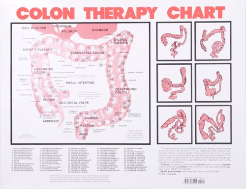 Colon Therapy Chart (9781570672415) by Dr. N.W. Walker D.Sc.