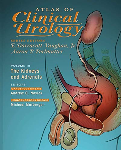 Imagen de archivo de Atlas of Clinical Urology : The Kidneys and Adrenals a la venta por Better World Books Ltd