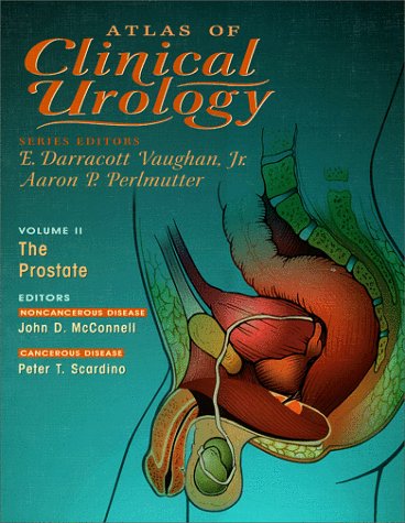 Stock image for The Prostate (Atlas of Clinical Urology) for sale by Irish Booksellers