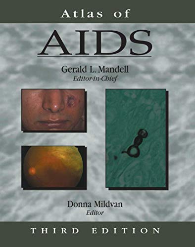 Stock image for Atlas of AIDS (Atlas of Infectious Diseases (Mandell)) for sale by The Book Corner