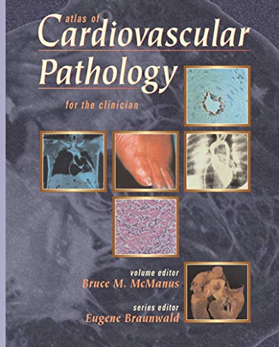 Imagen de archivo de Atlas of Cardiovascular Pathology for the Clinician a la venta por HPB-Red