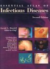 Essential Atlas of Infectious Diseases (9781573401678) by Mandell, Gerald L.; Bleck, Thomas P.; Mandell