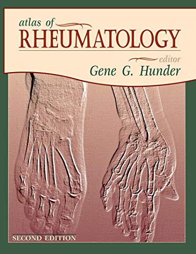 Stock image for Atlas of Rheumatology for sale by WorldofBooks