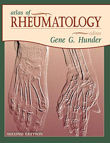 Stock image for Atlas of Rheumatology for sale by Better World Books