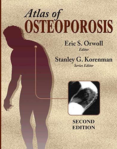 Stock image for Atlas of Osteoporosis for sale by ThriftBooks-Dallas